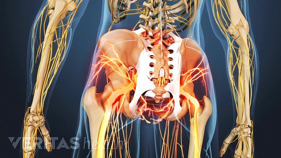 neck bone spurs breast pain Naked in german